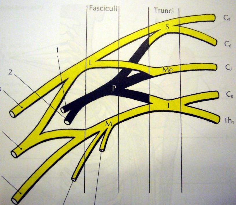Schéma plexus brachialis Ventrální větve C5 Th1 (C4) Truncus superior C5+6 Truncus medius - C7 Truncus inferior - C8+T1 Ramus anterior + posterior Fasciculus