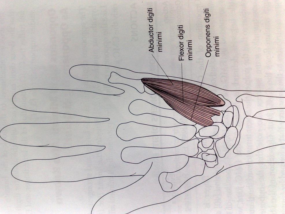 Hypotonus (atrofie) - hypertonus 13 m. abductor digiti minimi častější atrofie (snížení sv. síly ABD MCP kl., částečně opozice) m.