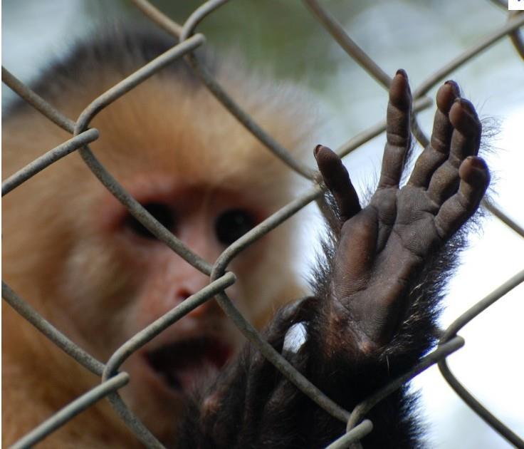 Paréza nervus medianus 30 Opičí ruka palec je přetahován m.