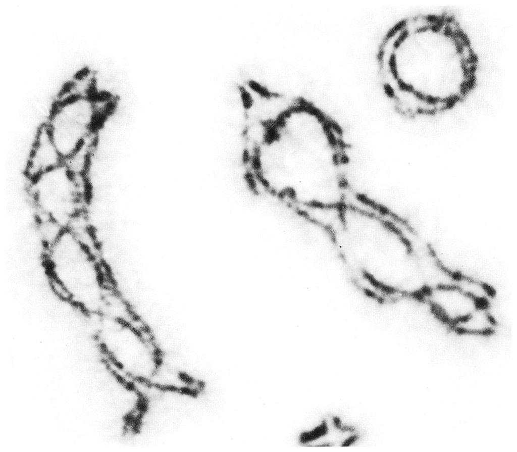 Průběh meiotického buněčného dělení Chromosomes showing the characteristic