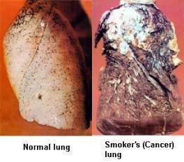 rakovina kouření cigaret = PAH (benzo[a]pyren) metabolisace CYP za