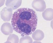 Imunotoxicita III.