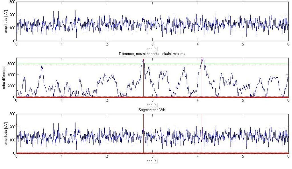 6.1.1 Stanovení mezní hodnoty - white_noise_for_af.m Metoda pomocí jednoduché míry diference mezi amplitudami a frekvencemi (Obr. 12).