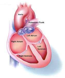 Syndrom DiGeorge 1:4000 Prenatálně: srdeční vada (stenóza aorty, FT) rozštěp patra/rtu