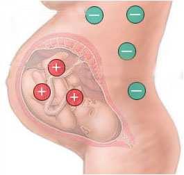 RhD genotypizace plodu identifikaci plodů v riziku fetální erytroblastózy u aloimunizovaných těhotenství redukce podávání humánního IgG