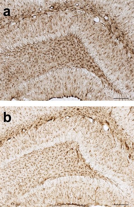 Profiling of a Rat Model of Early Immune Stimulation Figure 4. Microphotographs of GFAP immunoreactivity in the dentate gyrus (scale bar = 200μm). a) LPS treated group, b) Control group. doi:10.