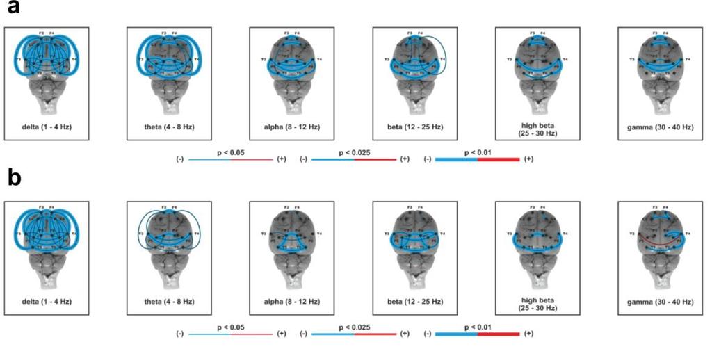 EEG koherence Psilocin signifikantně snižoval koherence ve všech frekvenčních pásmech - intra- i interhemisfreálně.