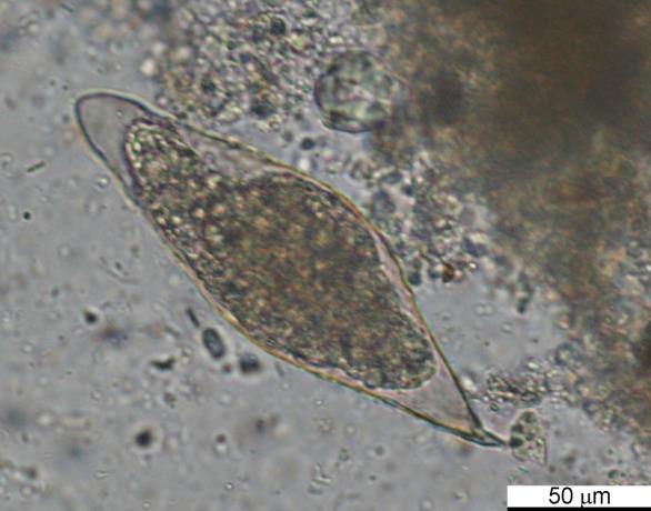 KOMENTÁŘ K VÝSLEDKÛM Fixované vzorky stolic: VZOREK : vajíčka měchovců (Necator americanus) četnost, vajíčka Trichuris trichiura, četnost C, vajíčka Schistosoma intercalatum ojediněle (nehodnoceno),