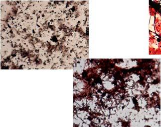 aktivační nádrž - zachycení biomasy pokles stáří kalu -průnik pěny do dosazovací