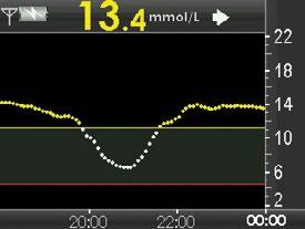 6.1.2 VÝSTRAHY GLYKÉMIE Systém Dexcom G4 PLATINUM umožňuje vytvářet vlastní osobní nastavení způsobu, jakým vám bude přijímač oznamovat, co se děje.