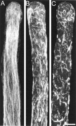 F-actin distribution of profilin-injected cells after chemical fixation and Alexa-phalloidin staining.