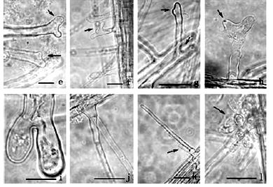 specifické, slabý defekt na kořenových vláscích mutant fh5 má zpožděnou celularizaci endospermu