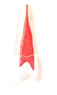 Vertucci