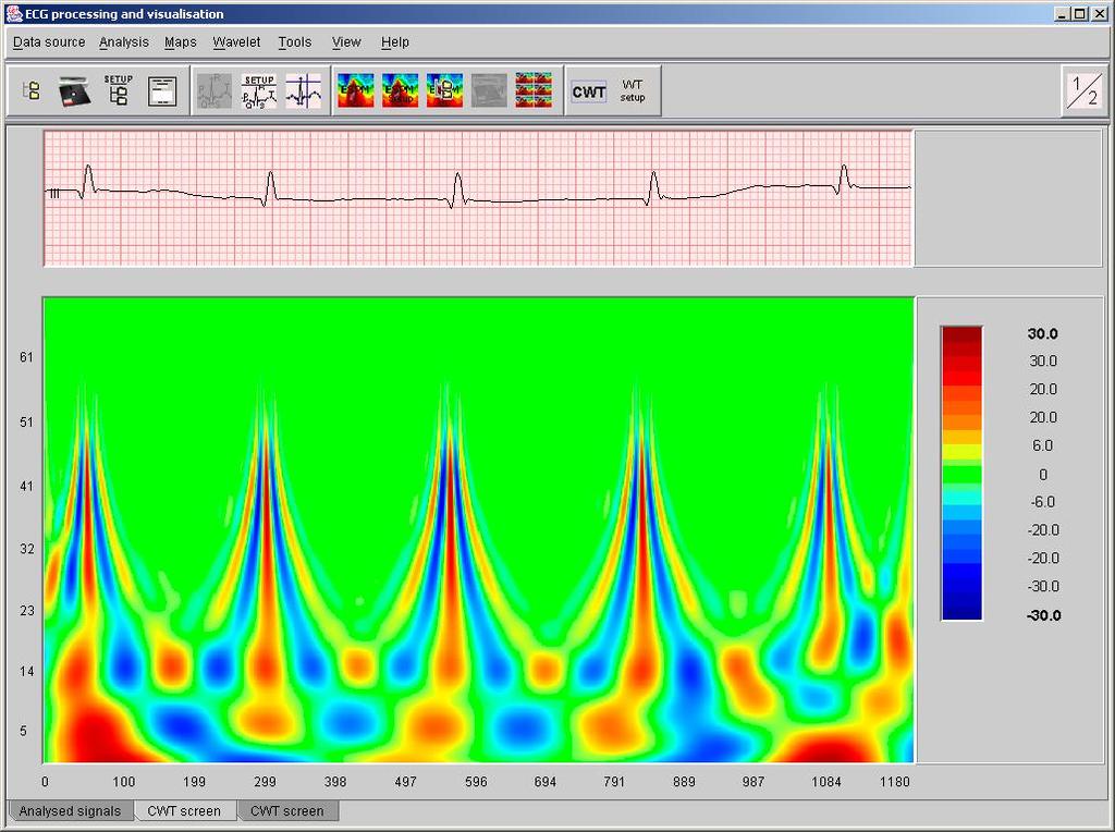 Příklad CWT vizualizace EKG Příklad