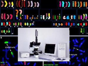 Klasické metody vyšetření Vyšetření karyotypu (hodnocení