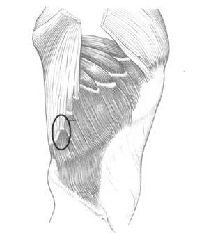 Další místa možné manuální intervence jsou pak úpony kolem lopatkových svalů (m. levator scapulae, m. trapezius,, m. subscapularis, m. pectoralis major et minor).