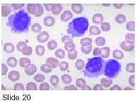 monocytopenia áno nie nie cytoplazmatické