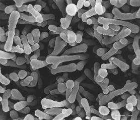 UTB ve Zlíně, Fakulta technologická 35 Zástupci rodu Bifidobacterium jsou gram-pozitivní, obligátně anaerobní, nepohyblivé, nesporulující tyčinky různého tvaru (krátké, pravidelné, tenké buňky se