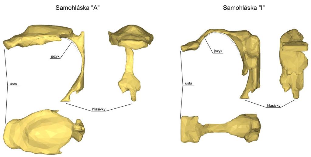 dutin v hrtanu, v těchto datech není obsažena geometrie nosních dutin.