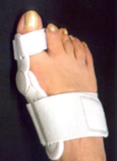 Příloha 9 Korektory deformity hallux valgus Obr.
