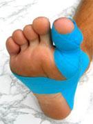 Příloha 10 Taping hallux valgus Obr.