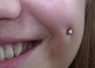 Obrázek 11 Piercing tváře 1.3.