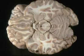 Složení mozkové tkáně šedá hmota (substantia grisea) perikarya neuronů, především nemyelinizovaná nervová vlákna