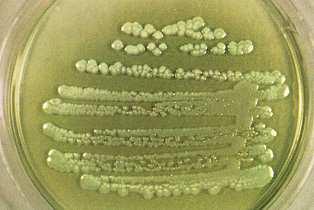 3. Gramnegativní nefermentující bakterie Většina z nich jsou tyčinky, ale rod Acinetobacter jsou