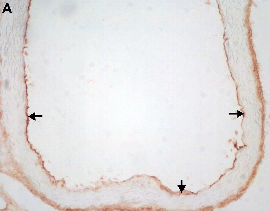 Obr. 1: Exprese VCAM-1 v endotelu aortálního sinu cholesterolové skupiny