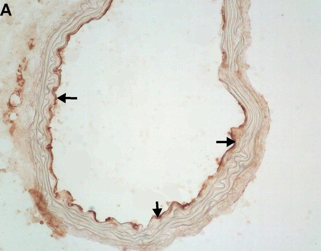 Obr. 2: Exprese endoglinu v endotelu aortálního sinu