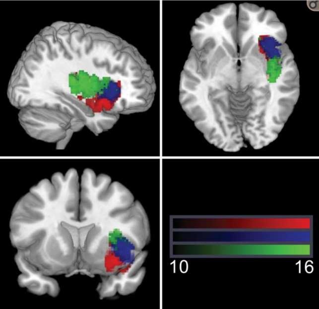Přední dorsální- kognitivní Přední ventrální- afektivně chemosenzitivní chuť, emoce (např.