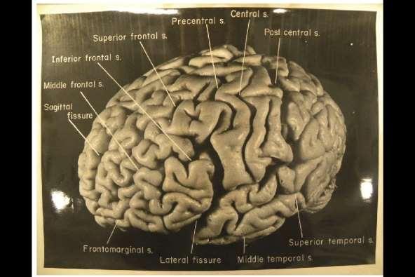 Einstein s brain left Nature News Snapshots explore Einstein s unusual brain Photos reveal