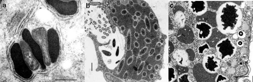 využívá je v procesu metanogeneze (Holmes et al., 2014).