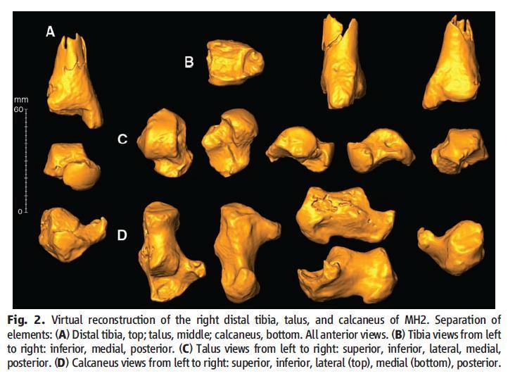 talus a