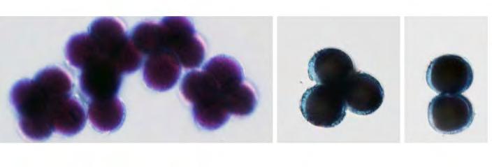 dělení buněk v rostoucích kořenech vojtěšky (Medicago sa va).