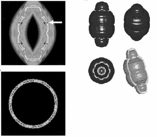 9. Vault RNA - přilepena na povrchu jaderné membrány a asociována s komplexem jaderných pórů - funkce neznámá, spíše funkční než strukturní (exp.