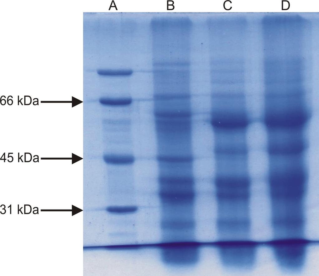 koloidní CBB (CBB-G2), lišících se především citlivostí a provedením (viz kapitola 4.4.). a) Barvení barvivem Commassie Brilliant Blue R-2 (obr.