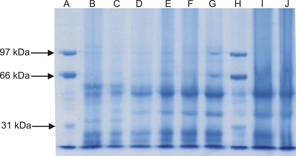 Porovnáním barvicích směsí bylo zjištěno, že pro účely této práce je výhodnější použít barvivo Commassie Brilliant Blue G-2, které ukázalo, že barví proteiny zafixované v gelu citlivěji a barva je