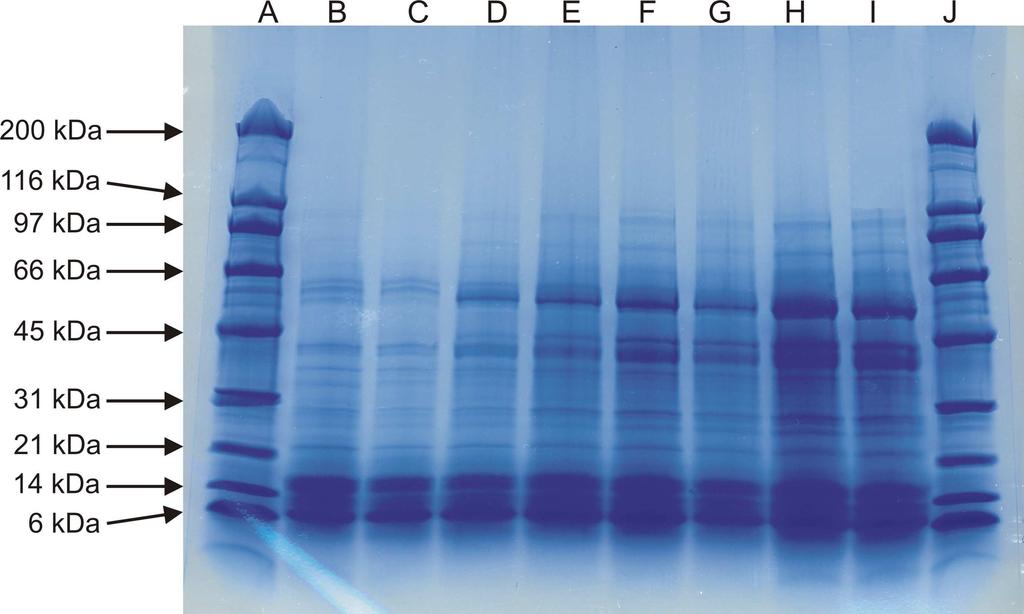 Naše pozornost byla nadále zaměřena na separaci proteinů ječmene při použití komerčních gelů firmy BIO-RAD a s nimi kompetentní aparaturou Mini PROTEAN 3 Cell.
