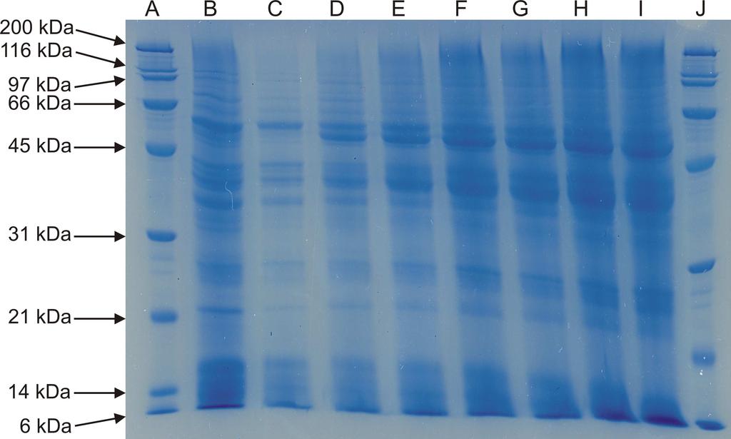 b) 15 % TRIS HCl gel Obr. č.21: A, J standardy, B - zrno, C - odběr z 1.dne sladování, D - odběr ze 2.dne sladování, E - odběr ze 3.dne sladování, F - odběr ze 4.dne sladování, G - odběr z 5.