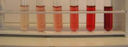 laboratoři) Mechanismy působení hemolýzy Uvolnění hemoglobinu a dalších intracelulárních látek do séra nebo plazmy - zvýšení koncentrace (K, LD, ) - snížení
