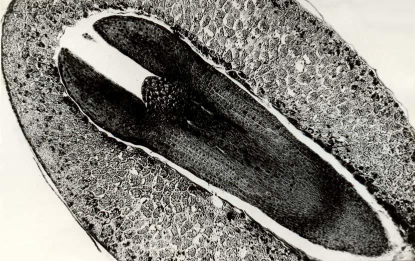 Embryo nahosemenných rostlin podélný řez semenem modřínu Larix dexidua (L.)MILL.