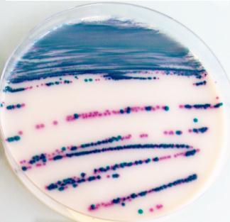 IRIS Salmonella Nová metoda