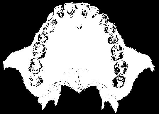 Hard palate