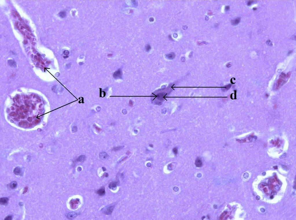 5 Výsledky 5.1 Kůra koncového mozku (Hematoxylin-eosin) Obrázek 15 - Preparát kůry koncového mozku (Hematoxylin-eosin).