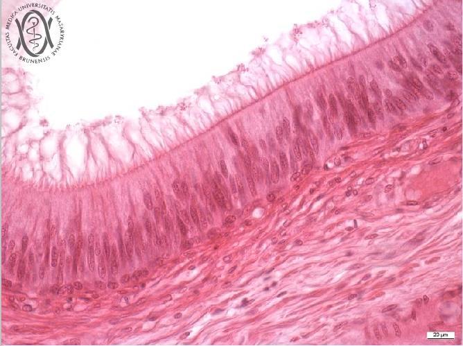 Stereocilie epitelové