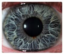 pupillaris) ohraničuje otvor zornici (pupilla) Facies anterior pigmentovaná Dva nestejné prstence