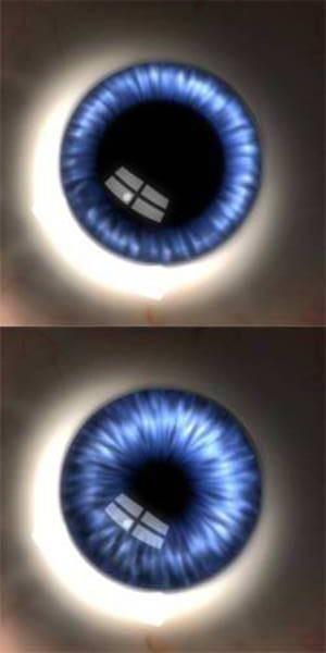 Facies posterior (přední stěna zadní komory oční) (camera posterior bulbi) Plnutí pigmentové vrstvy sítnice (tmavá barva) tenký černý lem kolem zornice Stroma řídké vazivo, pigmentové buňky,
