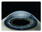 Rohovka (cornea): Tvar hodinkového sklíčka, segmentu koule 1/6 Přední konvexní strana (facies anterior) Vrchol (vertex corneae) Zadní konkavní strana (facies posterior) Substantia propria corneae -