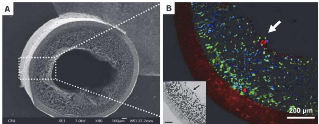 Nanofibers Production, Properties and Functional Applications 290 Fig. 3.